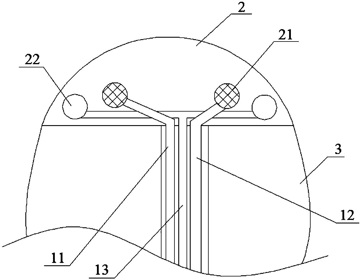 Hemostasis device for medical gynecological surgery