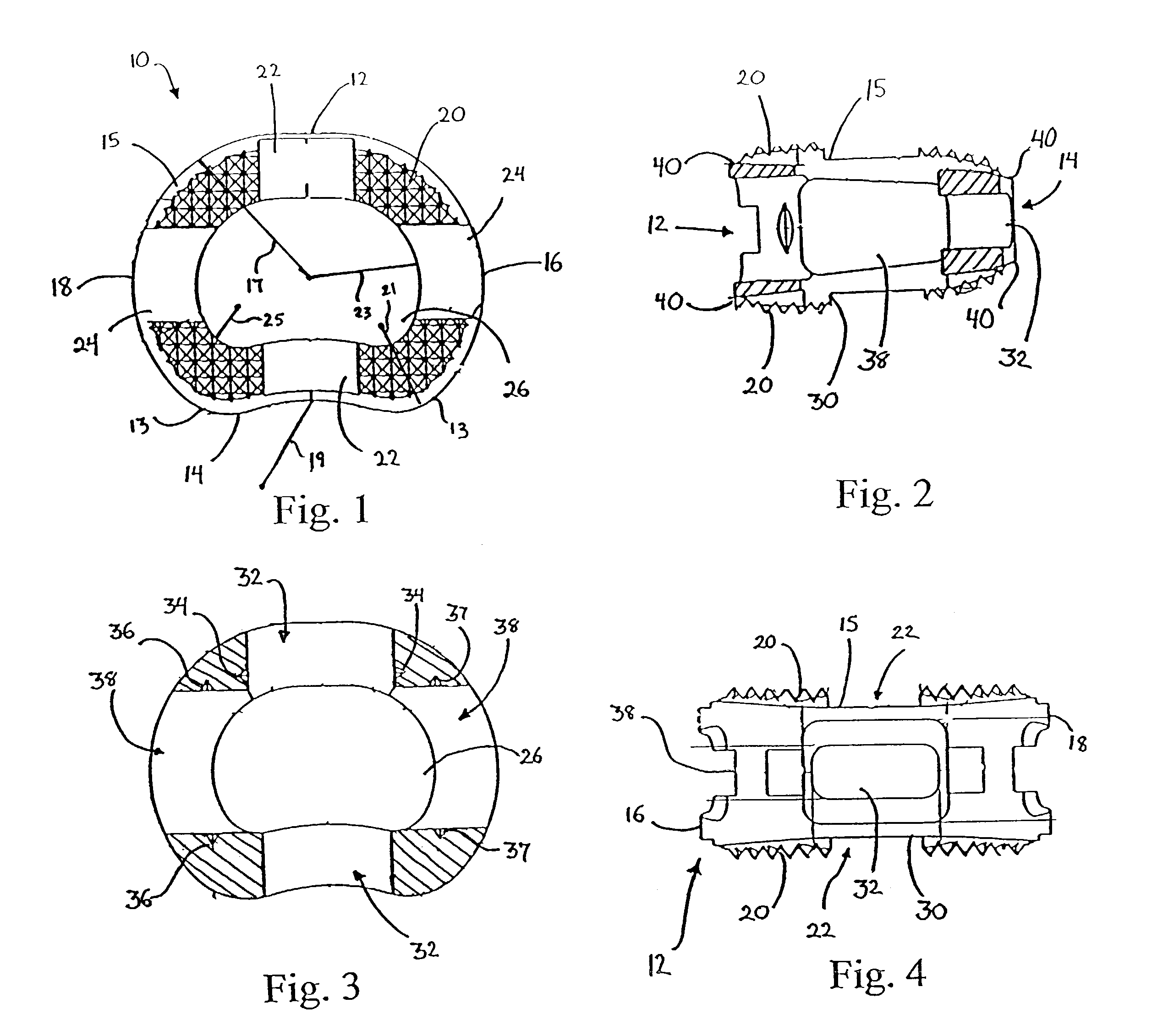 Intervertebral implant