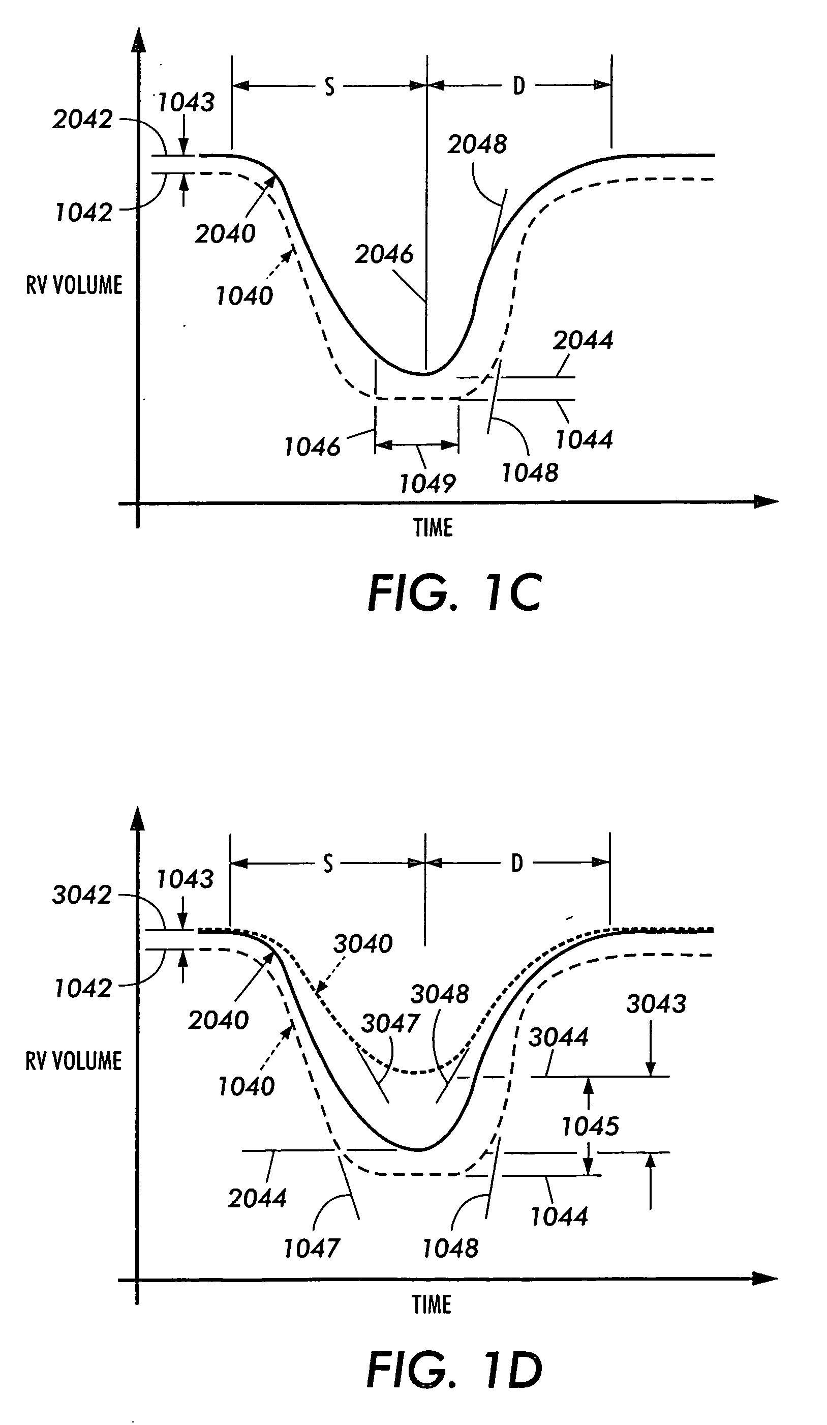 Sensor-equipped and algorithm controlled direct mechanical ventricular assist device