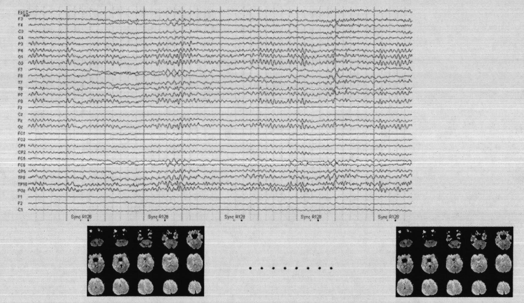 A Feedback System Combining EEG and Functional Magnetic Resonance Signals