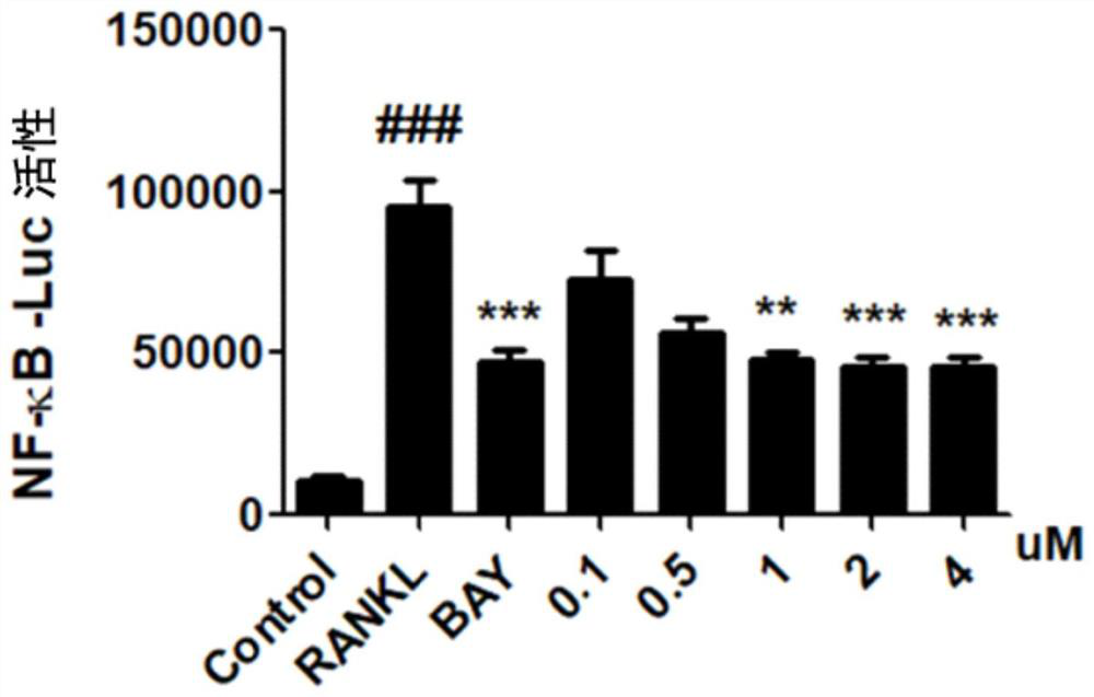 Application of equisetin in preparation of anti-arthritis drugs