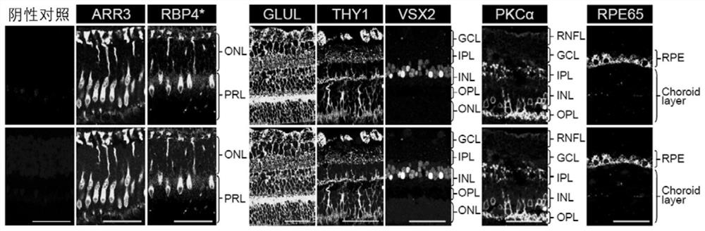 A marker for detection or auxiliary detection of retinal cone cells and application thereof