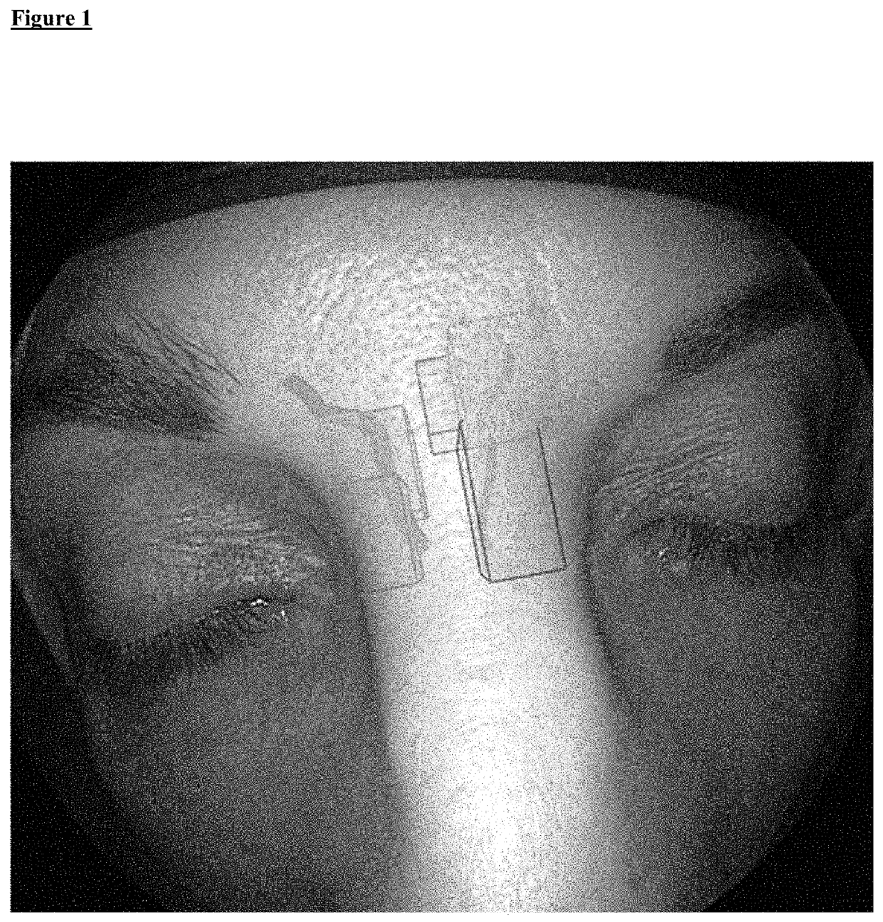 Instrument guidance system for sinus surgery