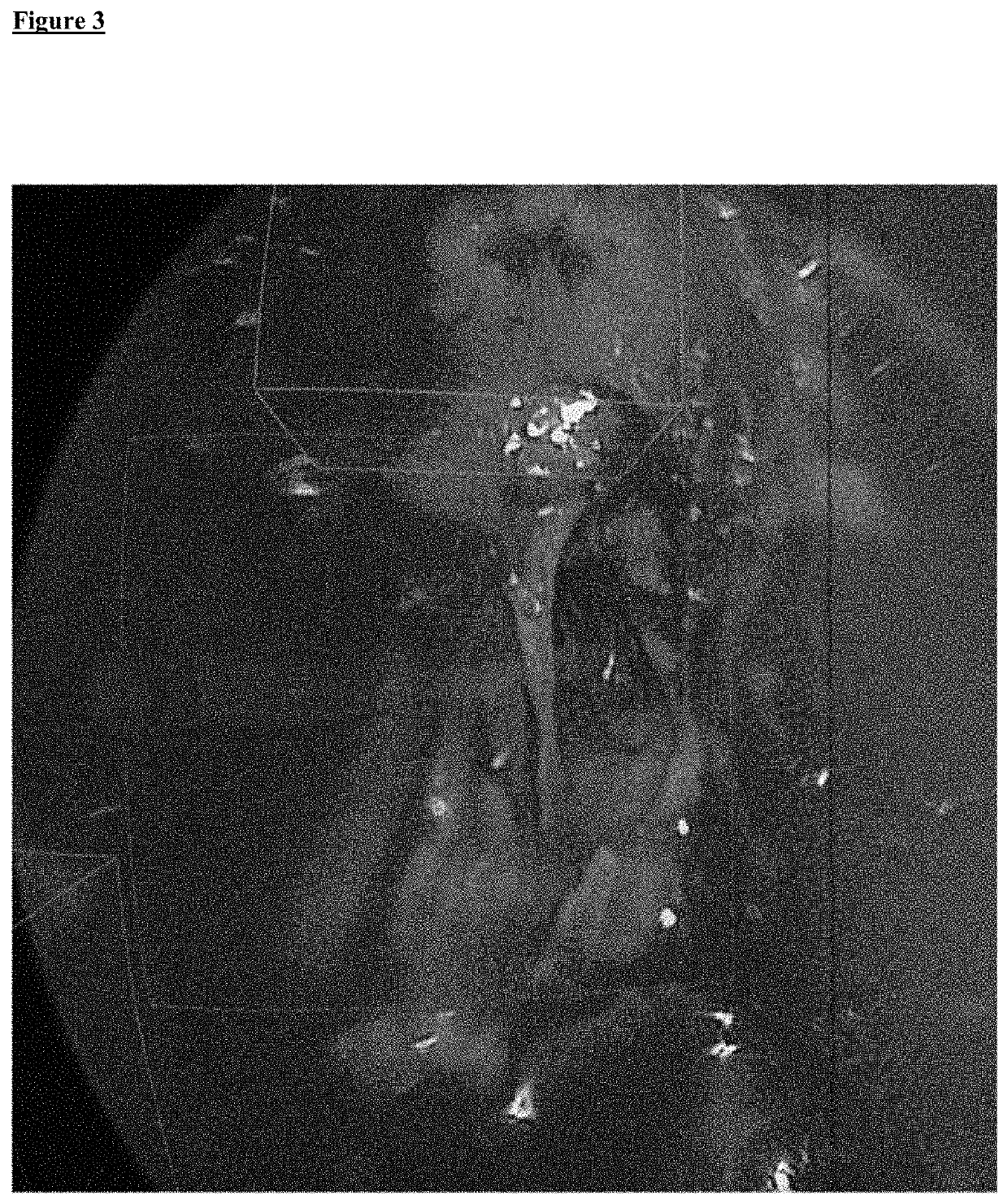 Instrument guidance system for sinus surgery