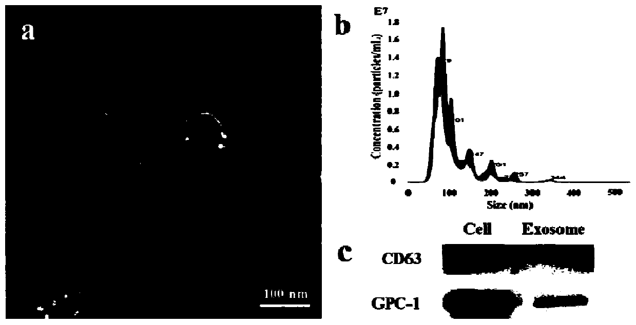 Tumor exosome nanometer fluorescence sensor based on magnetic separation and DNA self-assembling