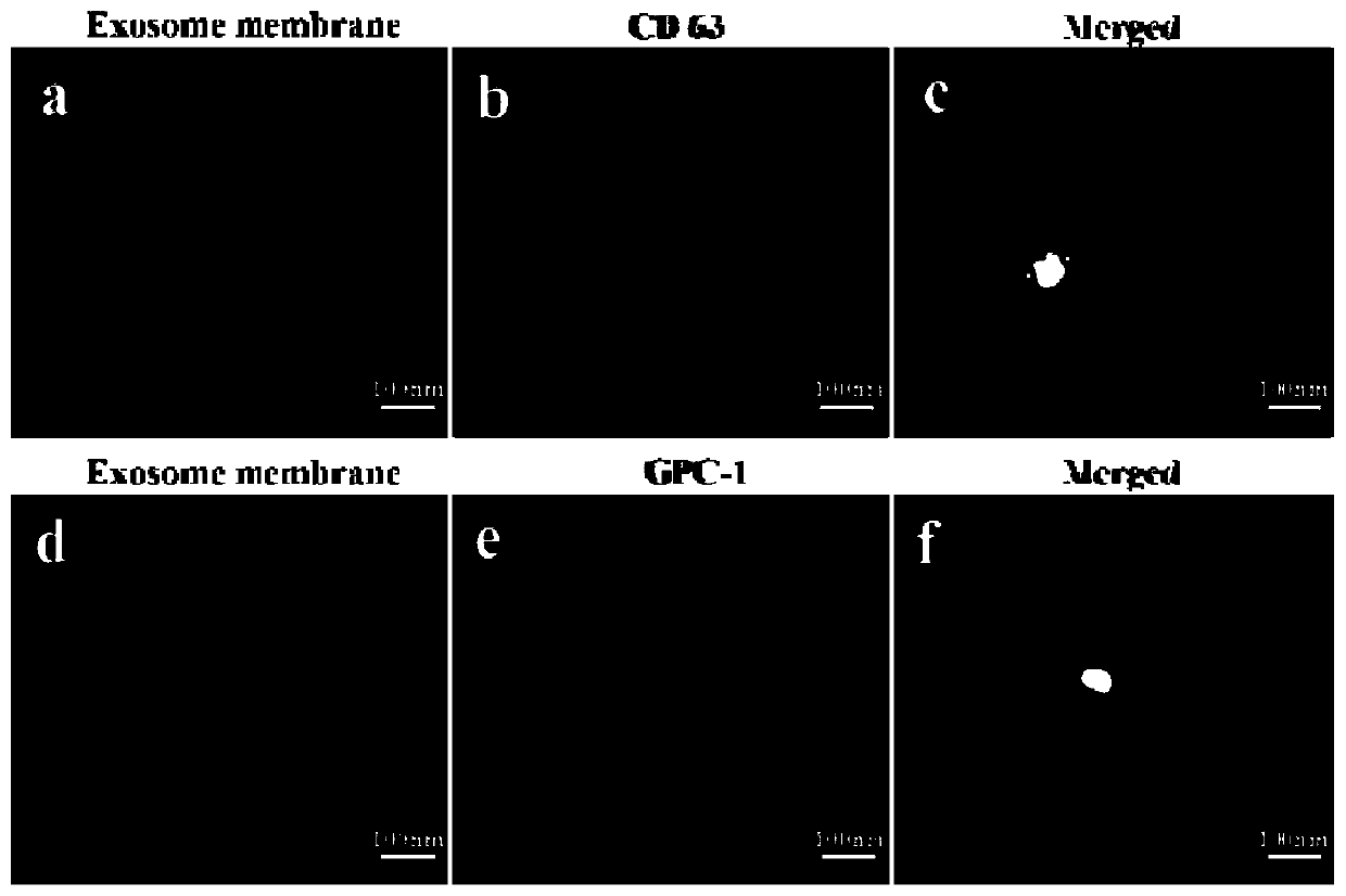 Tumor exosome nanometer fluorescence sensor based on magnetic separation and DNA self-assembling