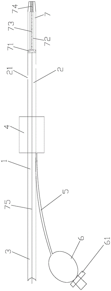 Gastrointestinal tube with magnetic electrodes