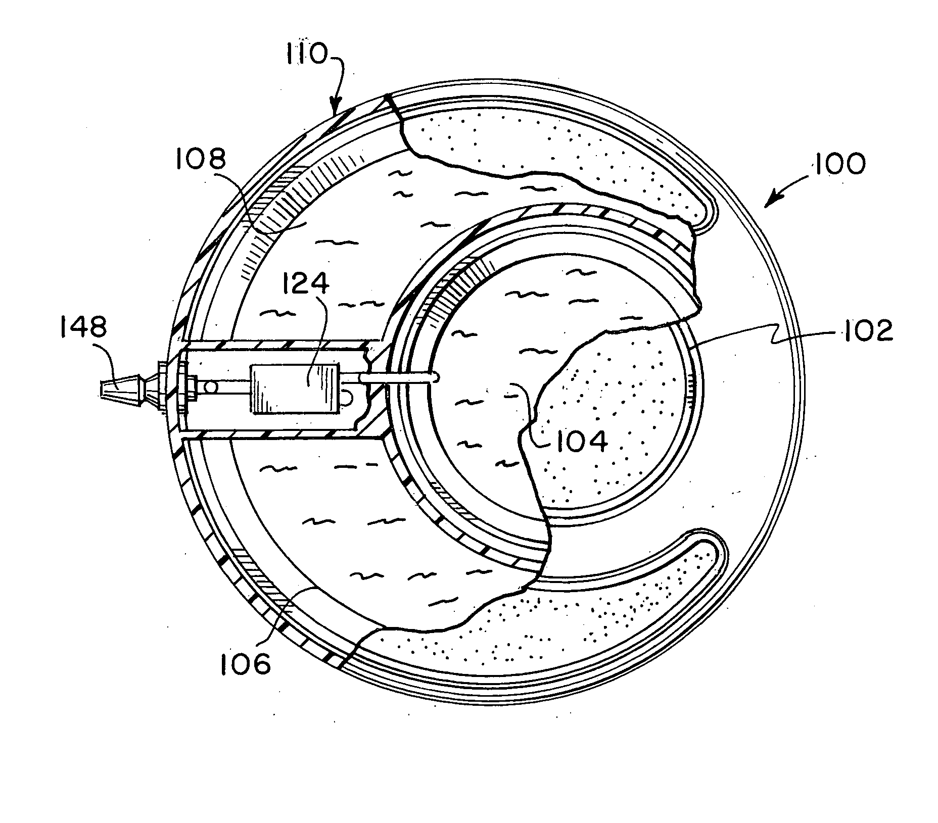 Two-compartment reduced volume infusion pump