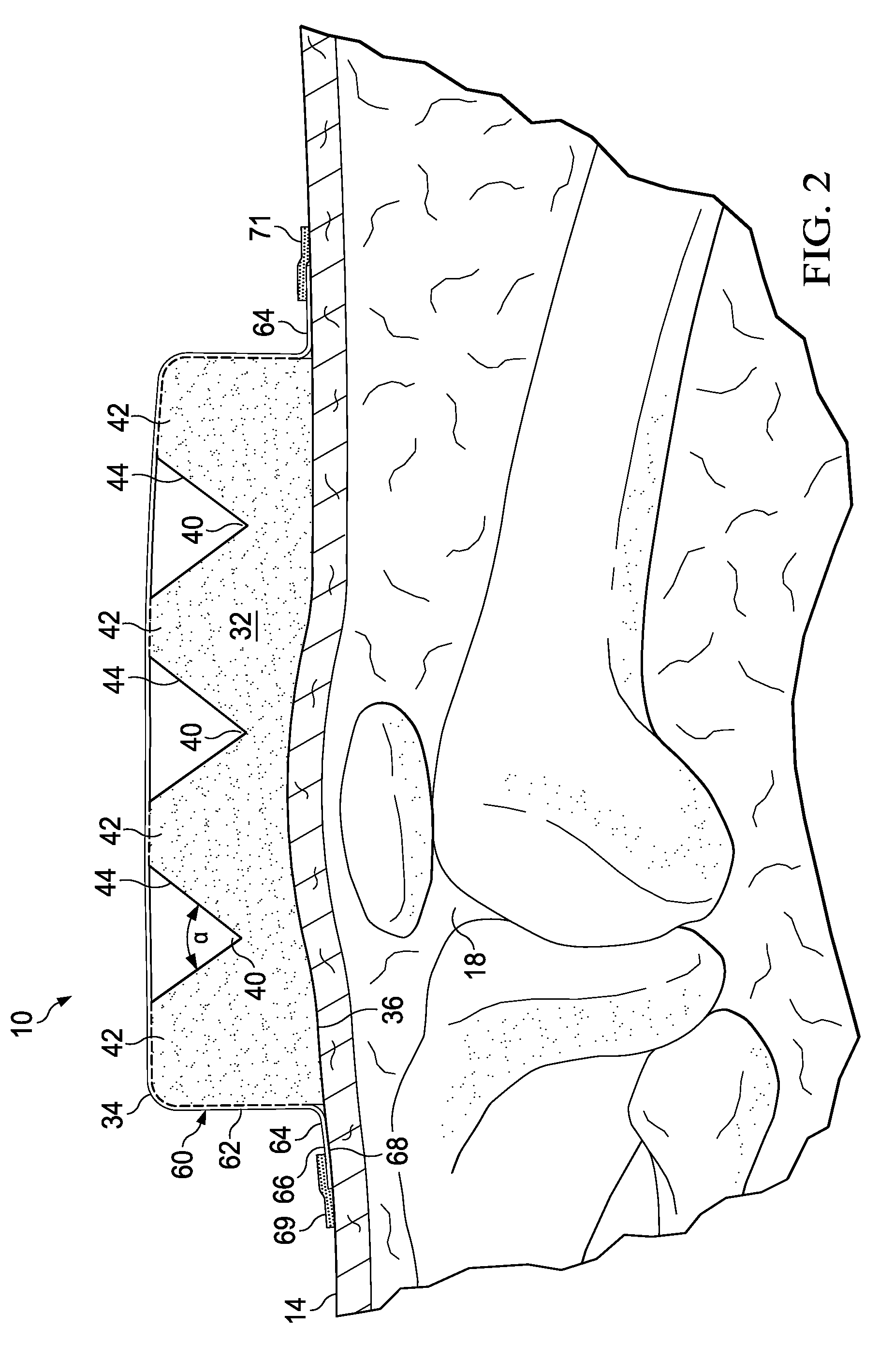 Reduced pressure, compression systems and apparatuses for use on joints