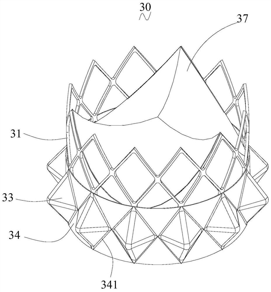 Heart valve prosthesis and heart valve prosthesis system