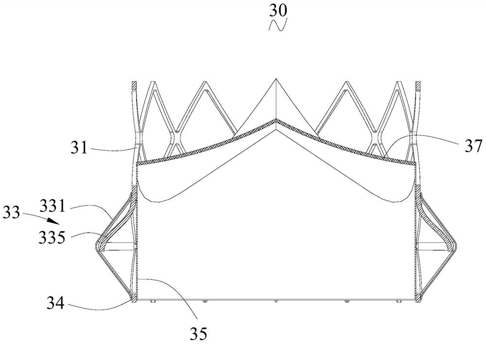 Heart valve prosthesis and heart valve prosthesis system