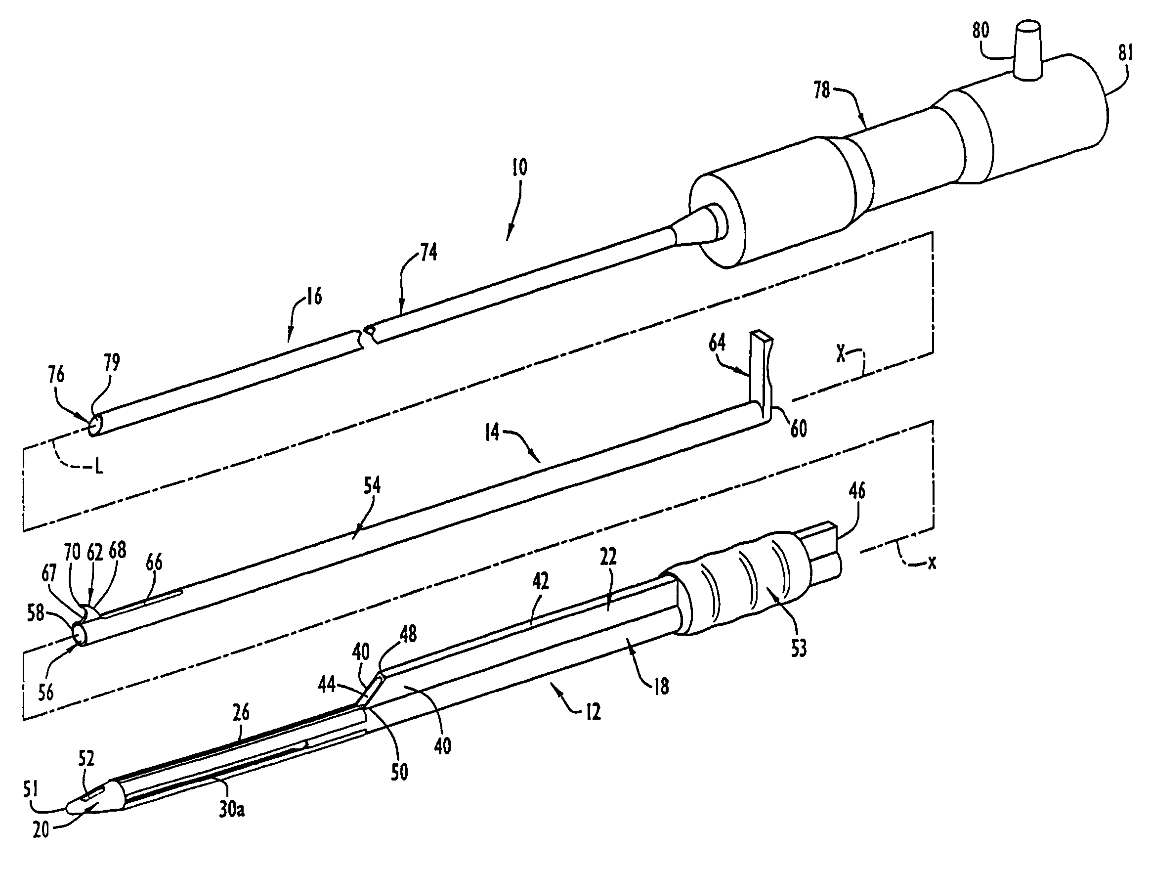 Instruments and methods for minimally invasive carpal tunnel release