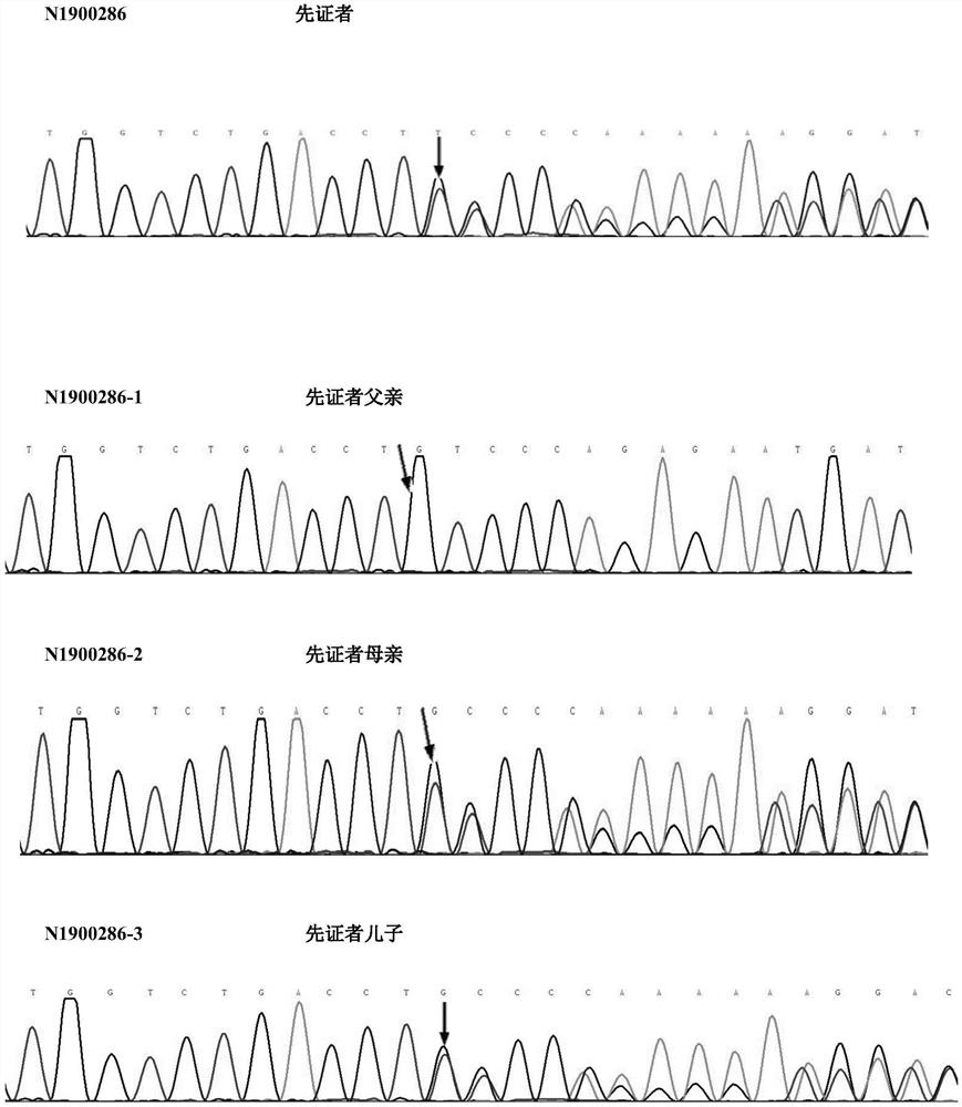 Premature coronary heart disease-related genes and their detection reagents and applications