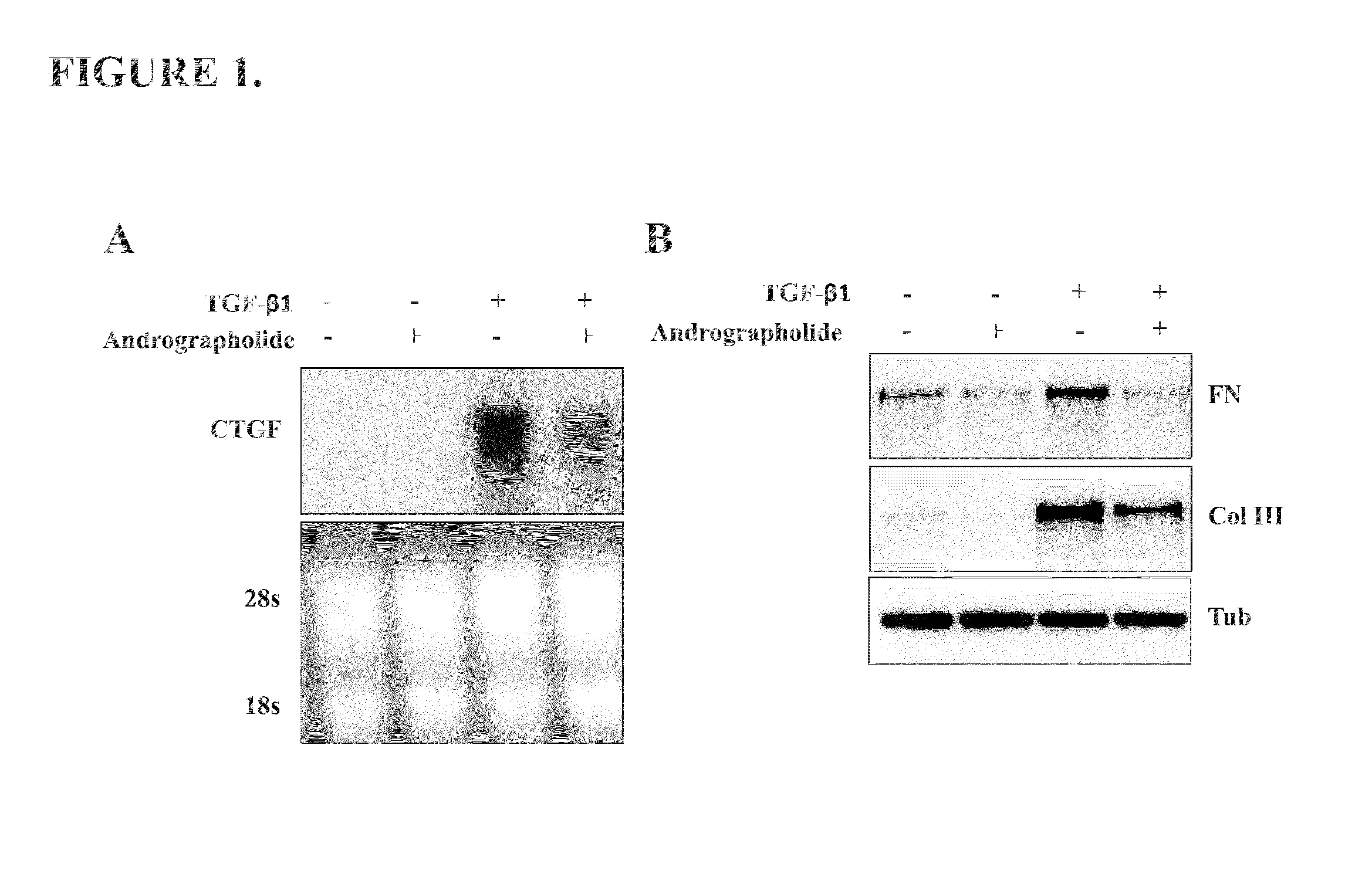 Pharmaco-cellular therapeutic method for the treatment of muscular dystrophies