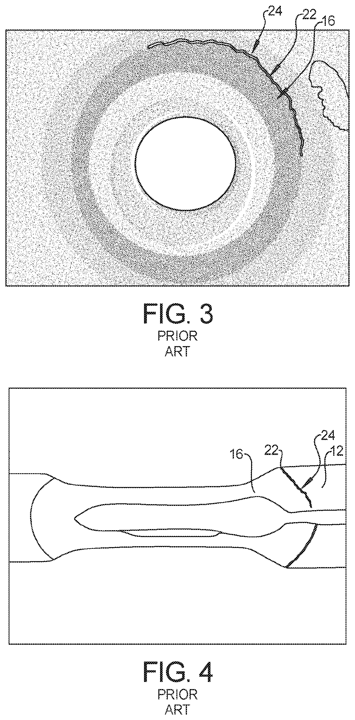 Pretreatment of weld flanges to mitigate liquid metal embrittlement cracking in resistance welding of galvanized steels