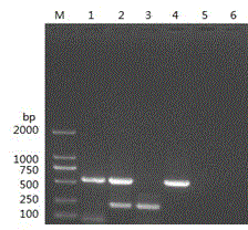 Canine distemper virus and canine coronavirus duplex PCR detection kit and detection method