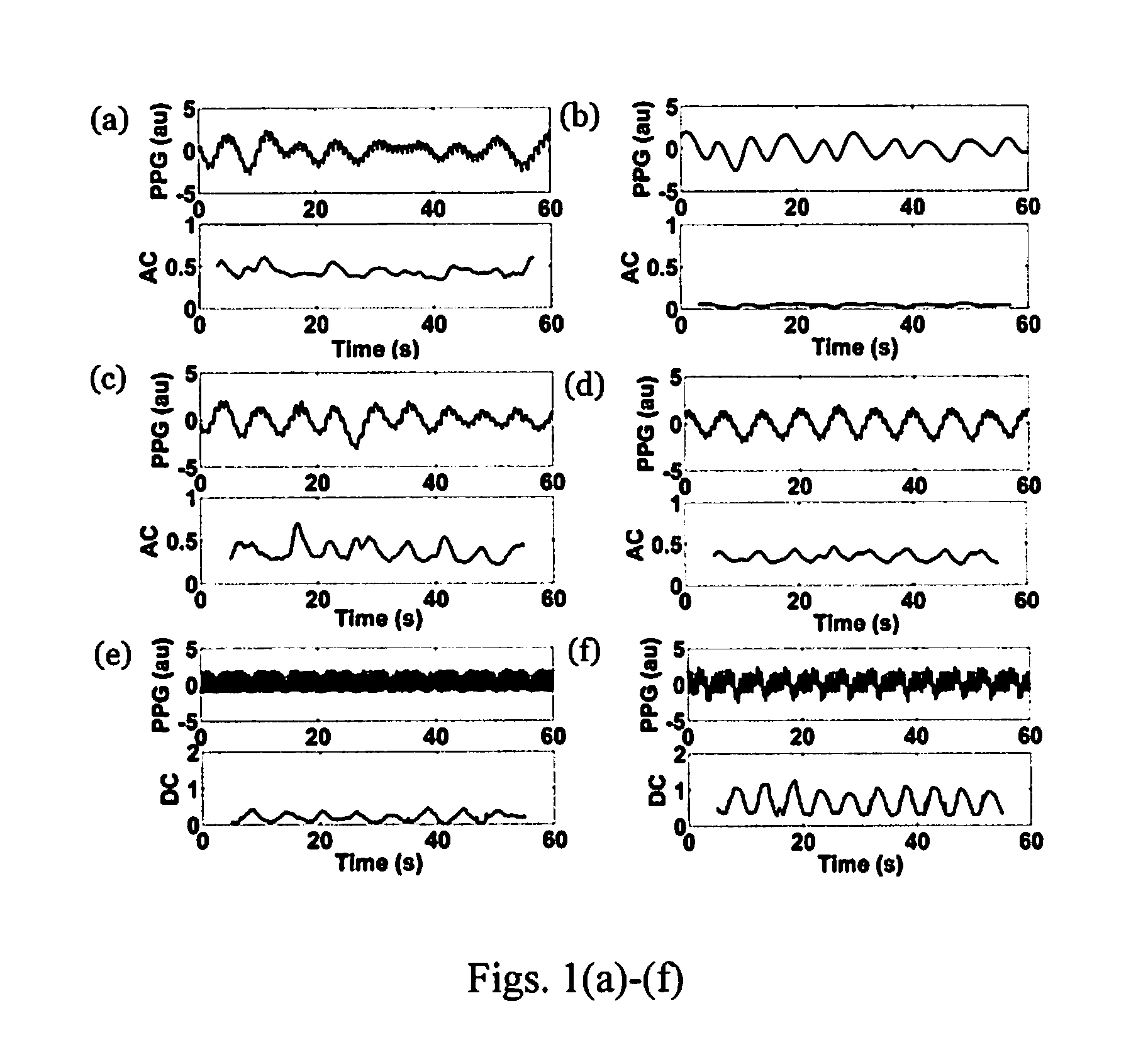 Apparatus and method for respiratory rate detection and early detection of blood loss volume