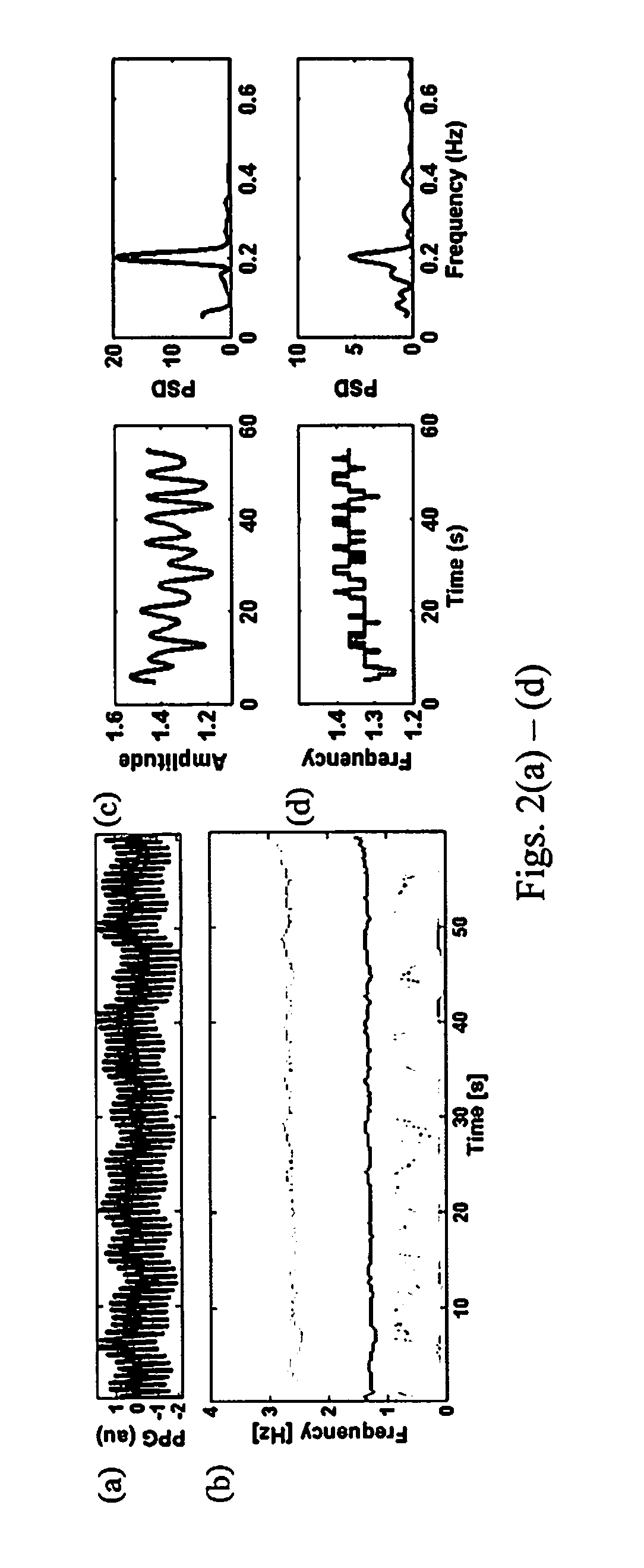 Apparatus and method for respiratory rate detection and early detection of blood loss volume