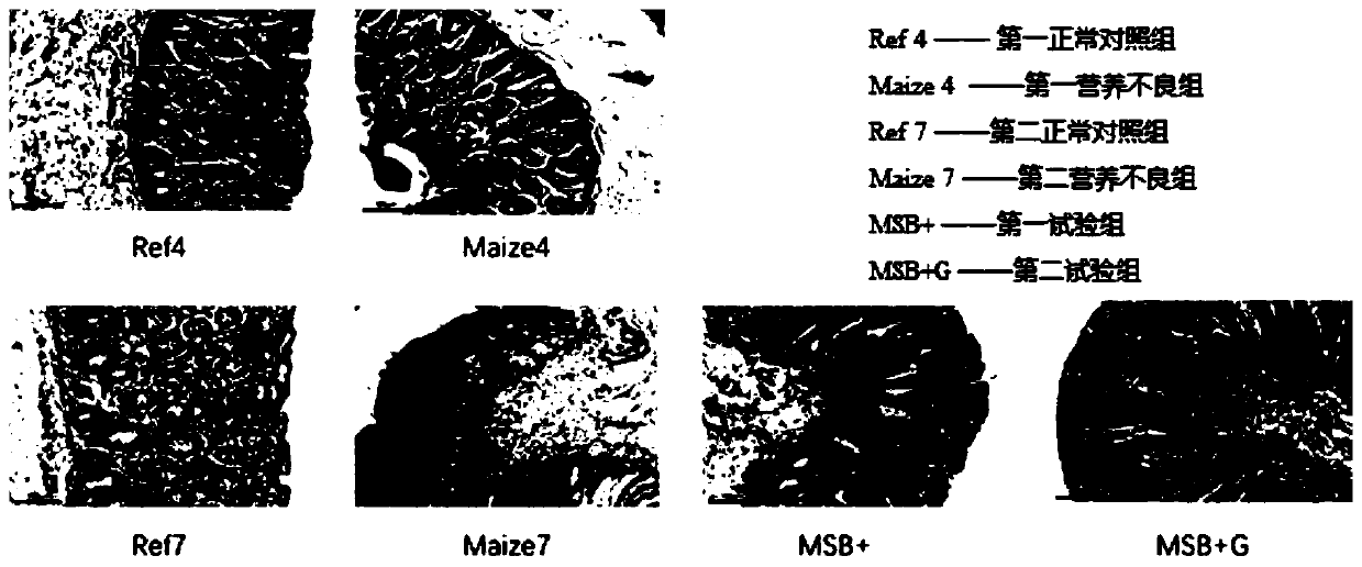 Dietary food for treating malnutrition and preparation method thereof