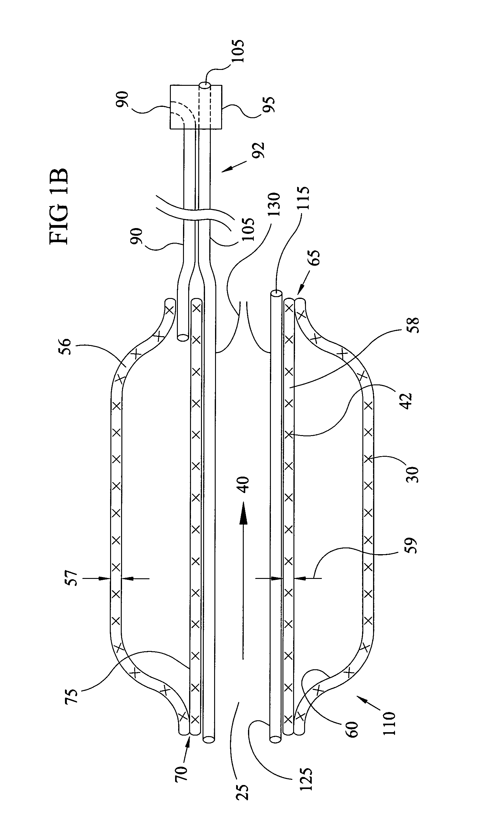 Expandable perfusion balloon