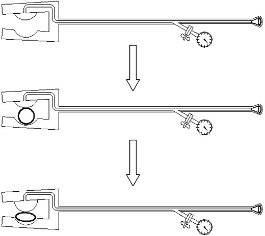 Renal artery directional blocking device