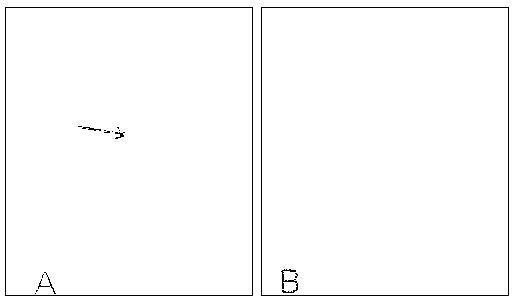 Medical application of ethane dimethane sulfonate (EDS)