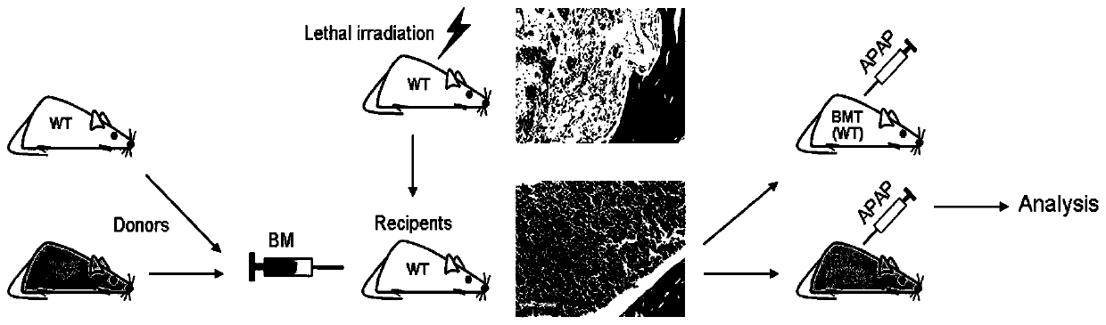 Application of peripheral blood mononuclear cell activation inhibitor in preparation of medicine for treating acute liver failure