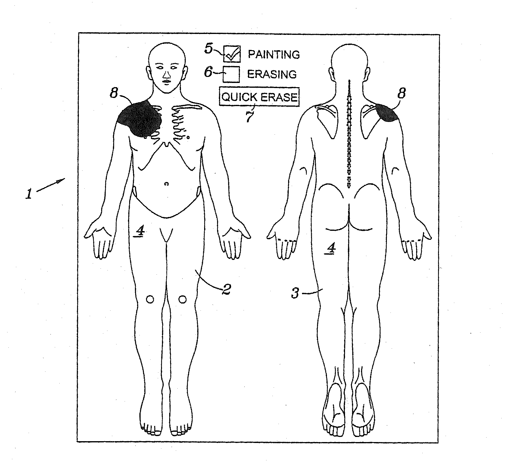 Computer pain assessment tool