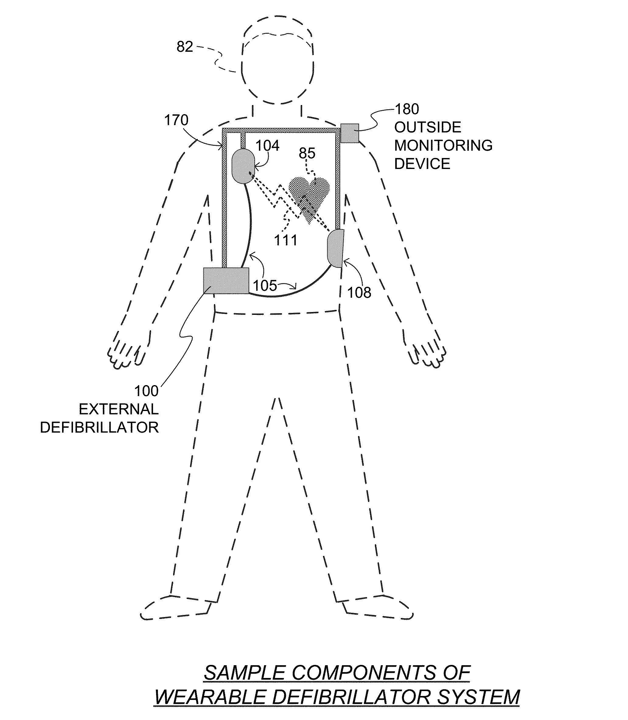 Wearable cardiac defibrillator system diagnosing differently depending on motion