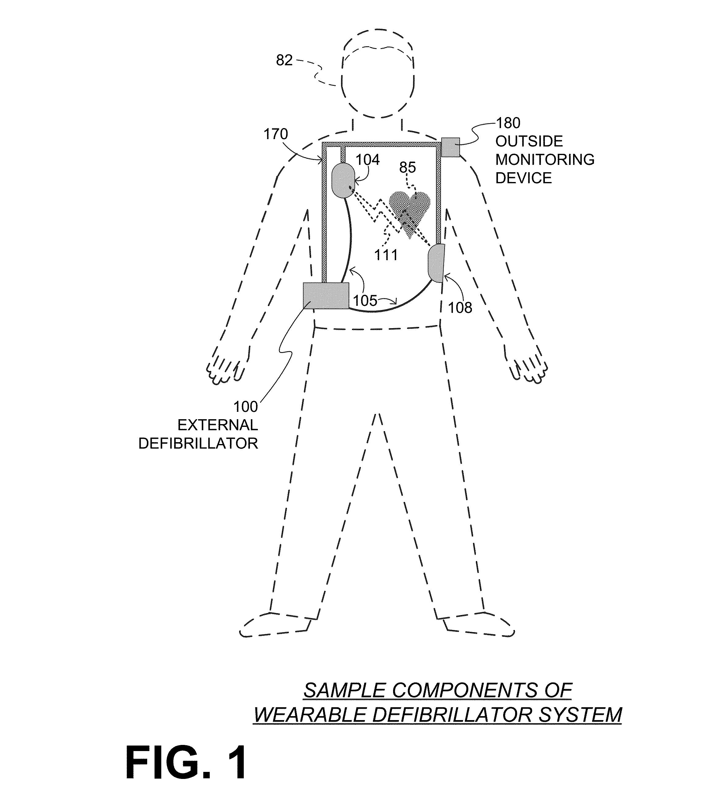 Wearable cardiac defibrillator system diagnosing differently depending on motion