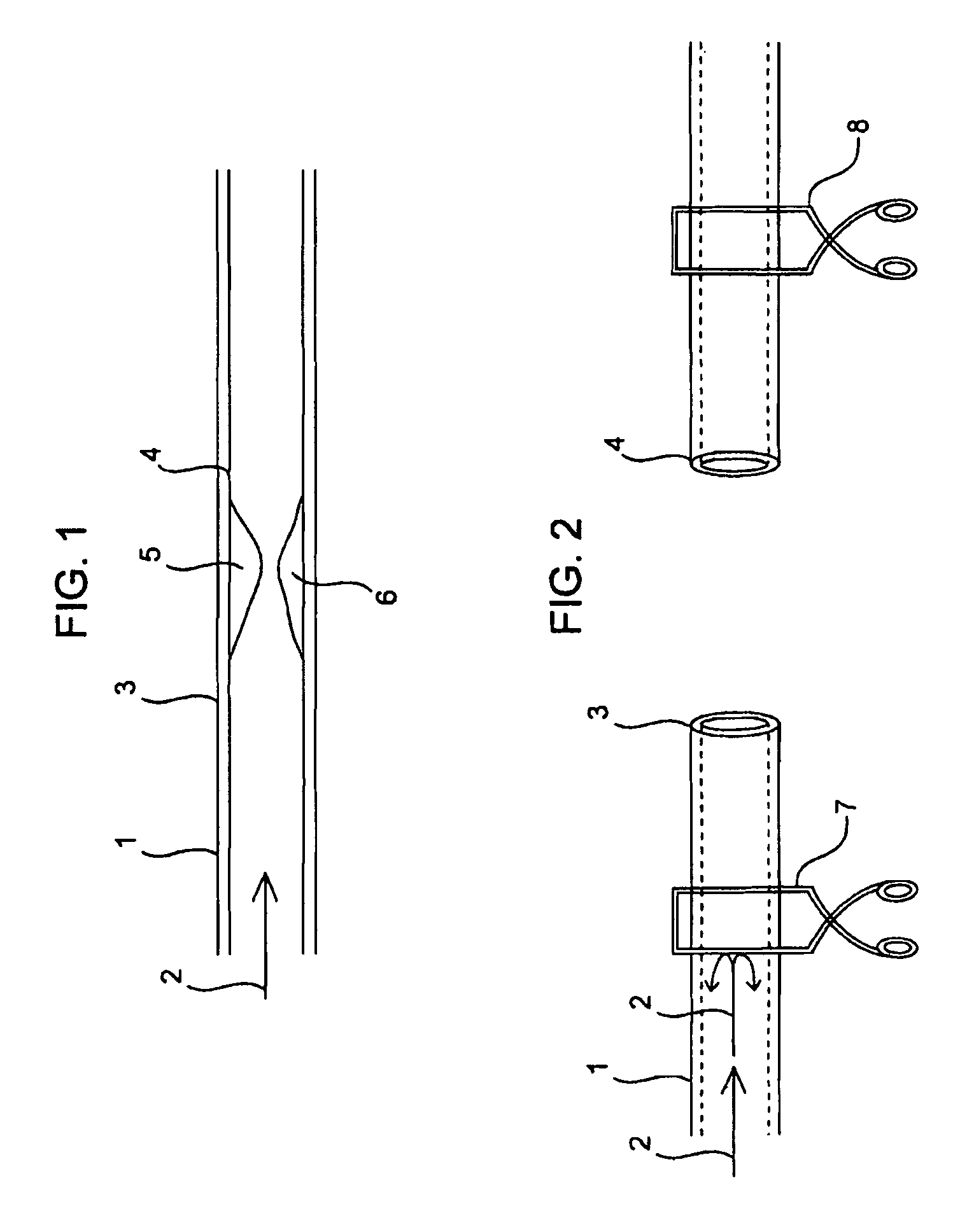 Compositions and methods for joining non-conjoined lumens