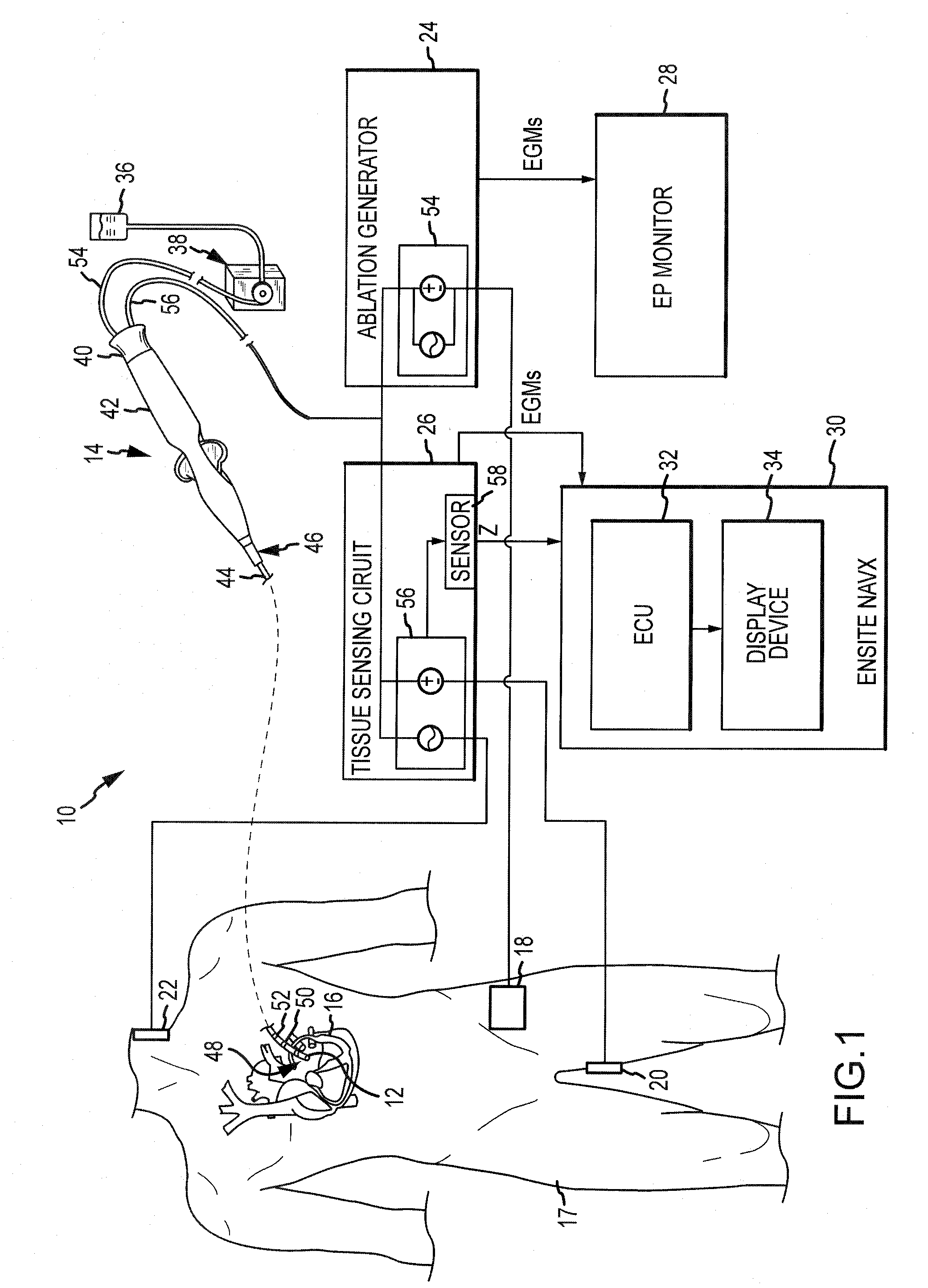 System and Method for Assessing Coupling Between an Electrode and Tissue