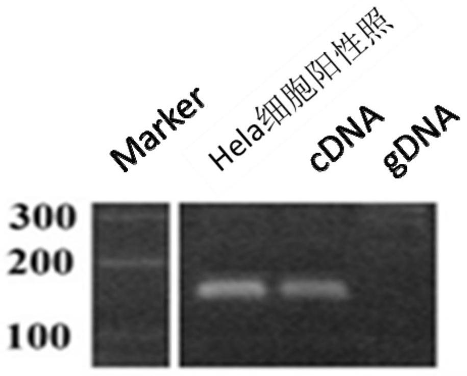 Uses of circular RNA circ-PTPRA