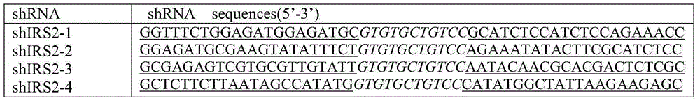 shRNA (short hairpin ribonucleic acid) capable of inhibiting IRS (insulin receptor substrate) 2 gene expression and application thereof