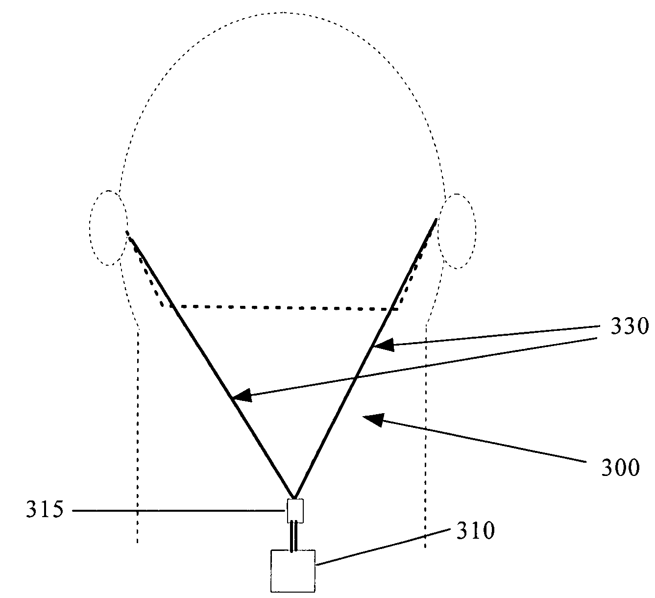 Wireless multiple input hearing assist device