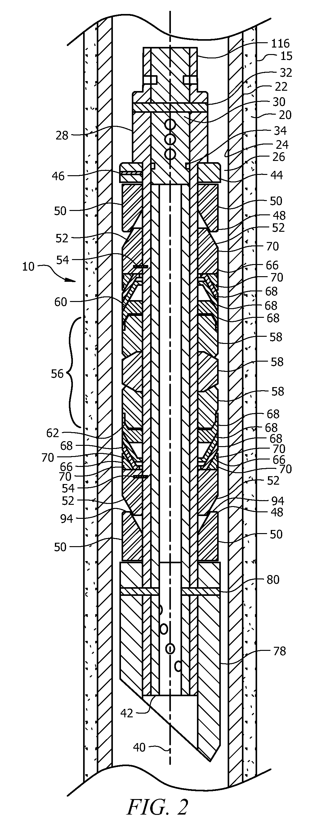 Expansion Device