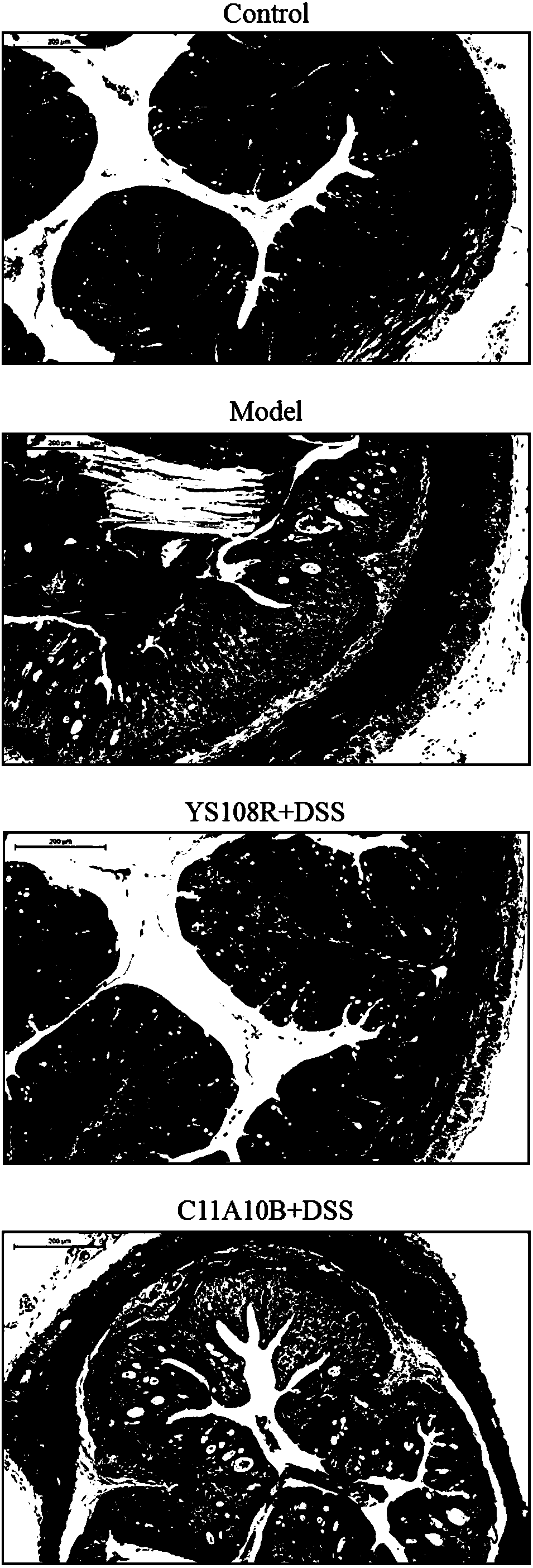 Bifidobacterium longum and application thereof