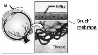 Blood retinal outer barrier model, construction method thereof and culture medium combination adopted for constructing model