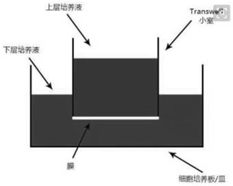 Blood retinal outer barrier model, construction method thereof and culture medium combination adopted for constructing model