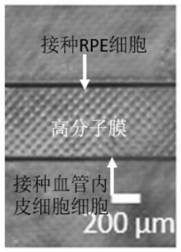 Blood retinal outer barrier model, construction method thereof and culture medium combination adopted for constructing model