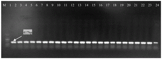 Application of biocontrol strain FZ01-GFP capable of expressing GFP to targeted pest epidemiology