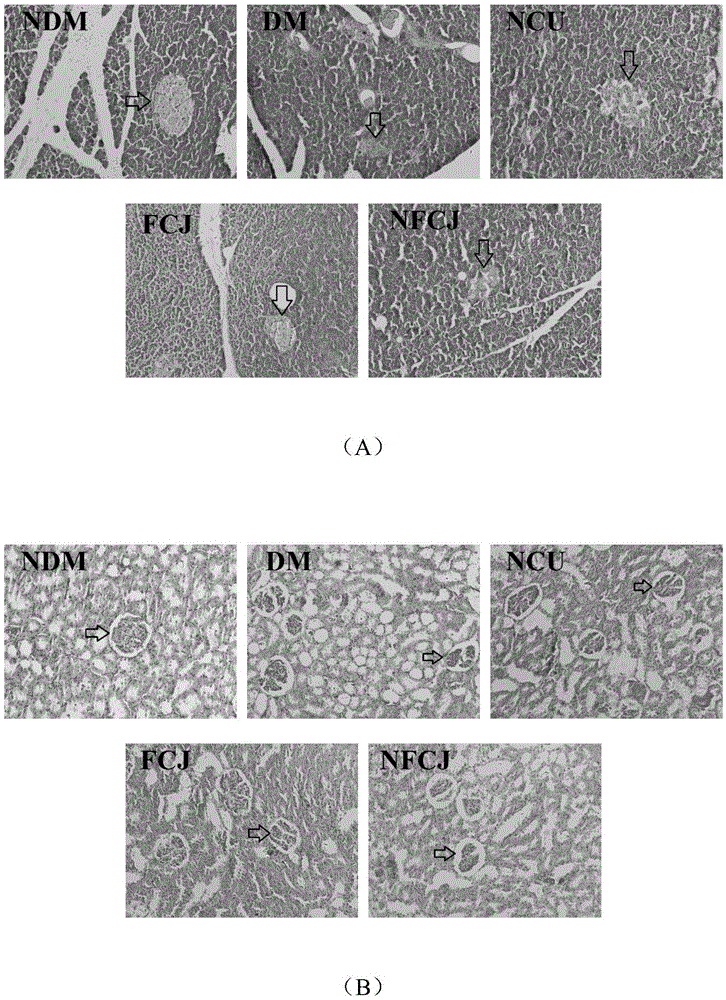 Lactobacillus plantarum having anti-diabetic function and application thereof