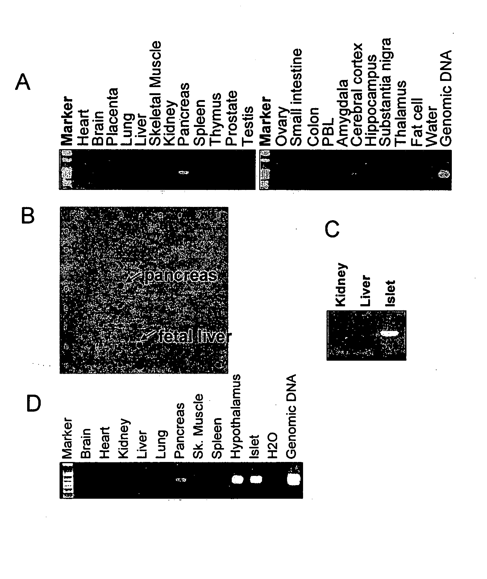 Substituted aryl and heteroaryl derivatives as modulators of metabolism and the prophylaxis and treatment of disorders related thereto