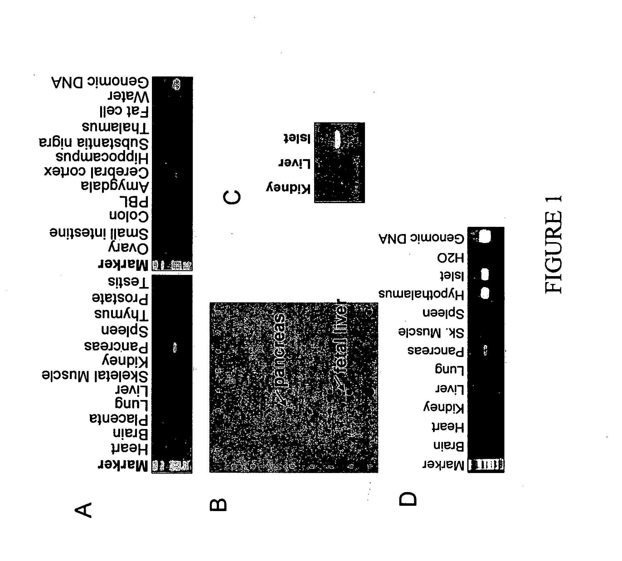 Substituted aryl and heteroaryl derivatives as modulators of metabolism and the prophylaxis and treatment of disorders related thereto