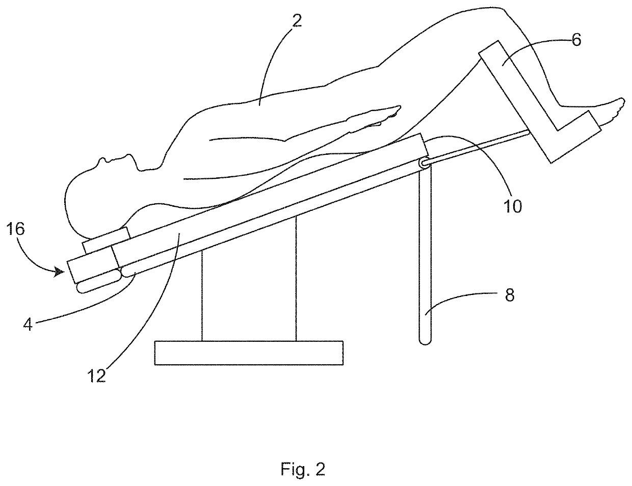 Patient securement system for the surgical trendelenburg position