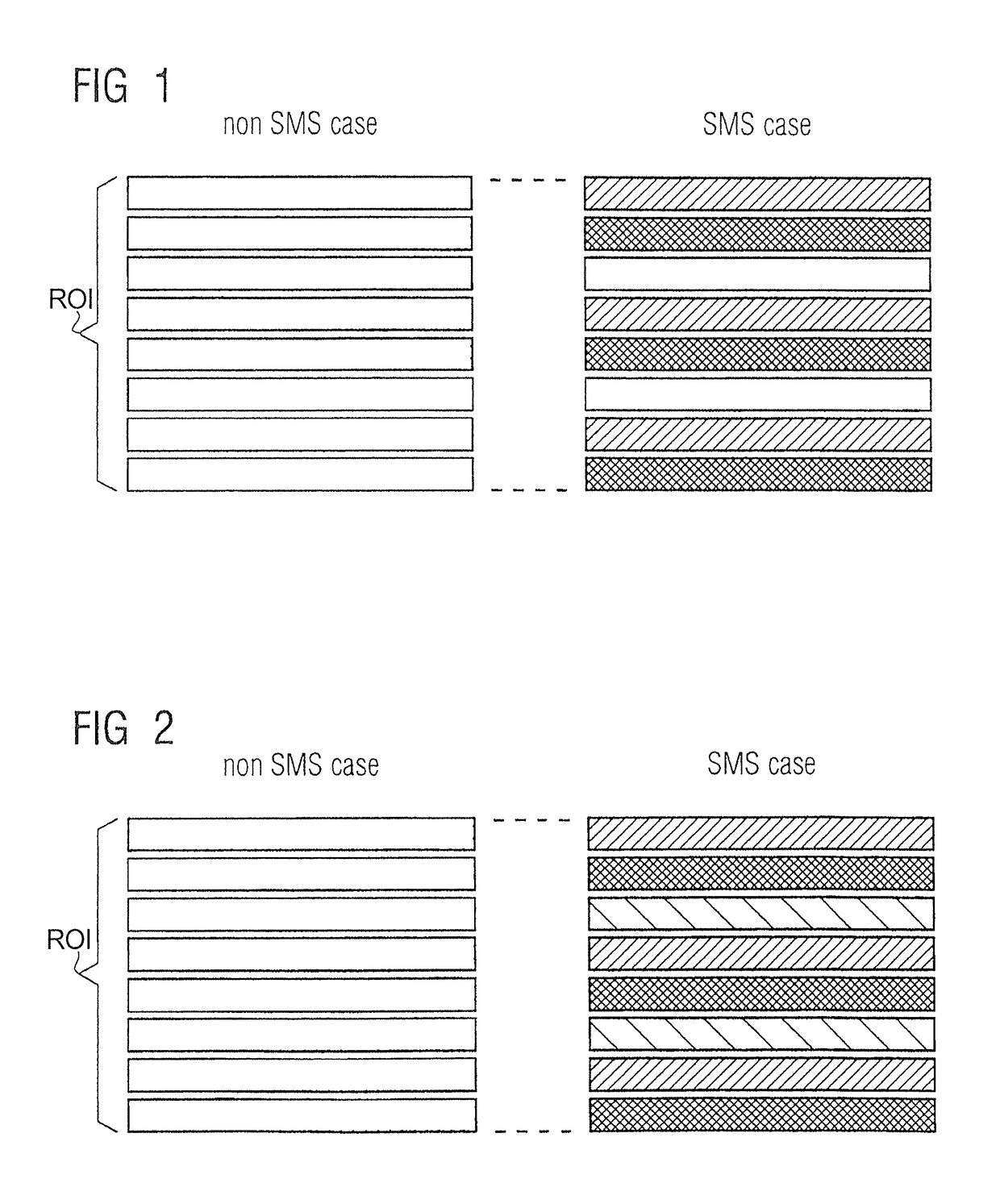 Magnetic resonance apparatus and method for simultaneous multi-slice imaging with arbitrary slice numbers