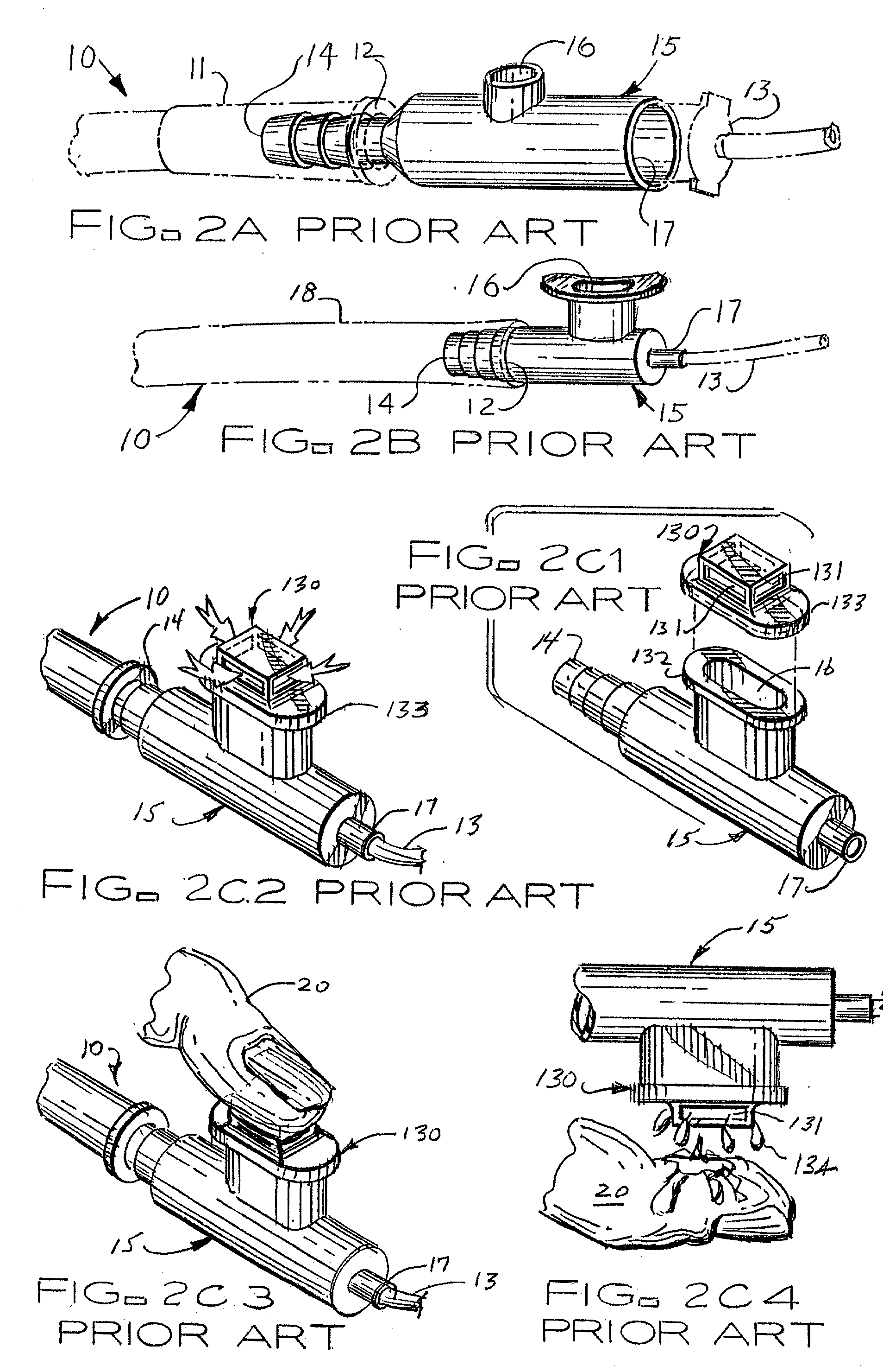 Medical component system