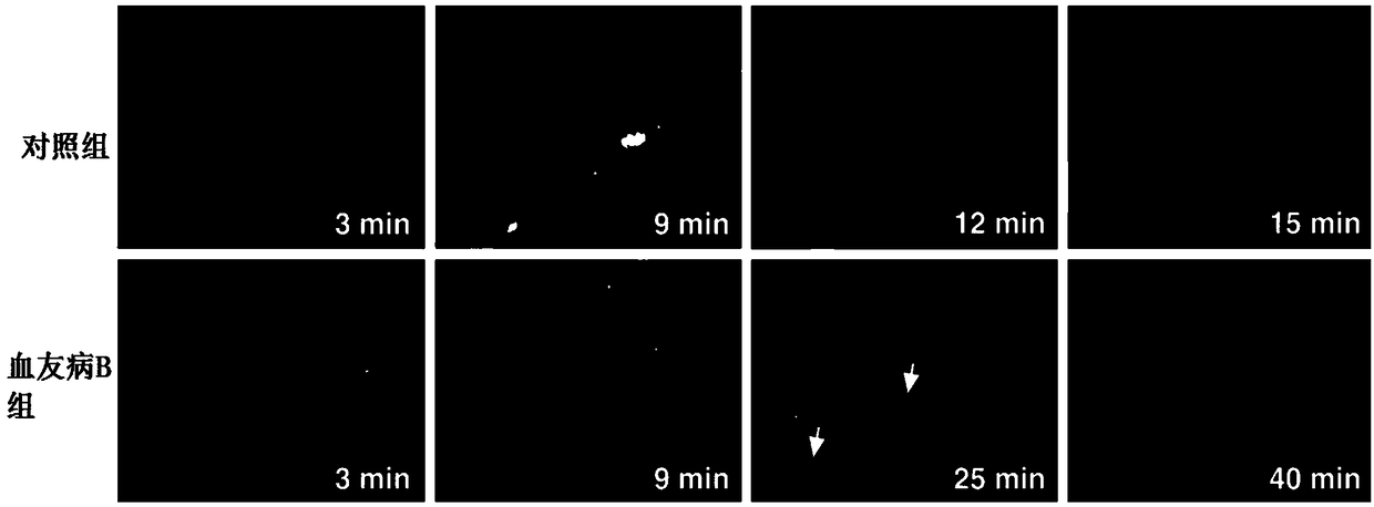 Pharmaceutical composition of hemocoagulase and application of pharmaceutical composition