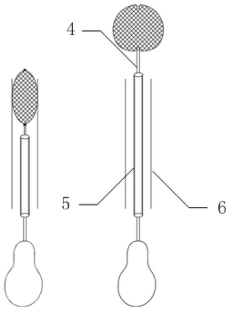 Aneurysm plugging device and preparation method thereof