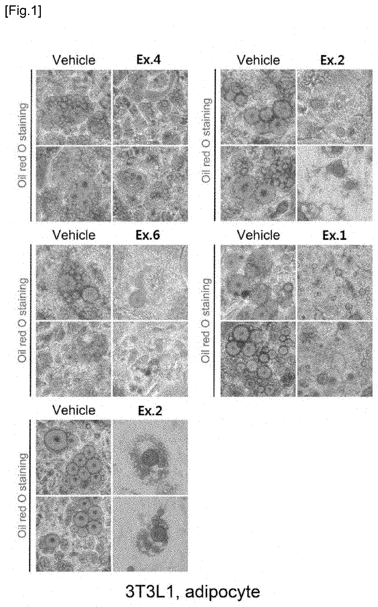 Novel compound and pharmacetical composition for preventing or treating obesity or metabolic syndrome comprising thereof